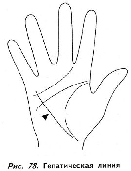 http://www.e-reading.co.uk/illustrations/111/111377-_77.jpg